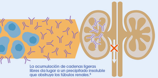 Insuficiencia renal